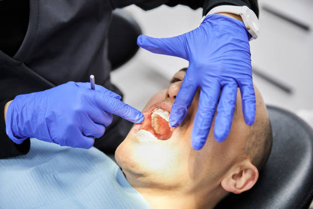 Best Broken or Cracked Tooth Emergency Dentist in Jupiter, FL